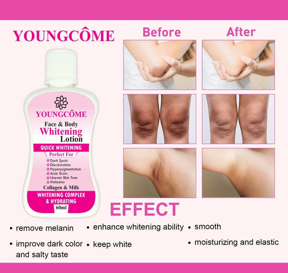 YOUNGCOME 60ml Face Body Whitening Lotion Underarm - Image 2